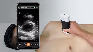 Cardiac Parasternal View  Ultrasound Scanning Technique [upl. by Down]