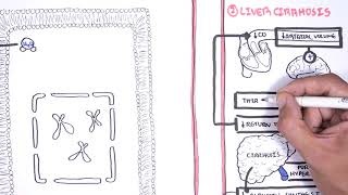 Hyponatraemia Hyponatremia  classification causes pathophysiology treatment [upl. by Kore803]