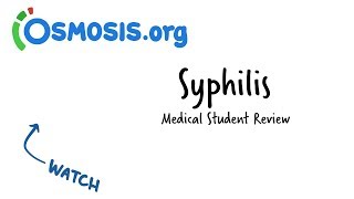 Chorionic Villus Sampling CVS [upl. by Charmian542]