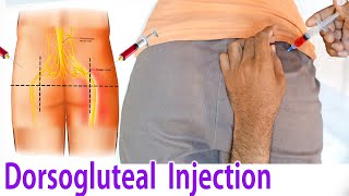 How to give an intramuscular IM injection in buttock hip at home dorsoglutel Injection technique [upl. by Eads305]