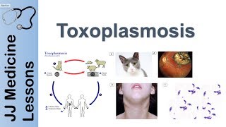 Toxoplasmosis  Acquired vs Congenital  Signs Symptoms Diagnosis and Treatment [upl. by Sparky25]