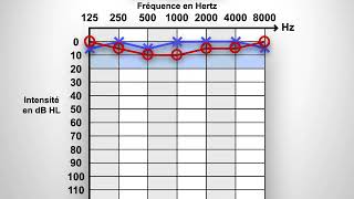 Audiogramme [upl. by Airotna]