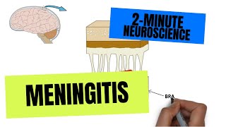 4 Bacterial Meningitis Treatment amp Prevention [upl. by Acinoreb]