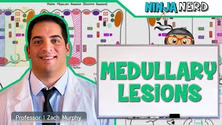 Medullary Lesions Medial and Lateral Medullary Syndromes [upl. by Consuelo]