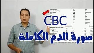 CBC ازاى تقرا تحليل صورة الدم الكاملة [upl. by Auqenes]