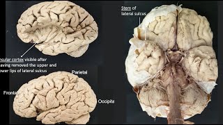 Lateral sulcus [upl. by Schram525]