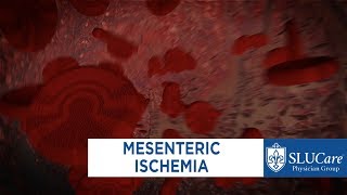 Mesenteric Ischemia  SLUCare Vascular Surgery [upl. by Dawkins]