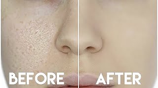 HOW TO HIDE ENLARGED PORES amp MAKE YOUR PORES DISAPPEAR [upl. by Otsuaf839]