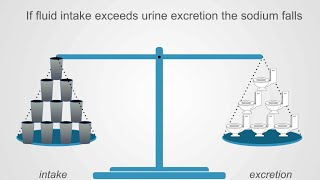 Hyponatremia Basics Understanding Water Intake amp Urine Output [upl. by Gare]