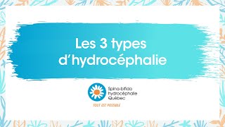 Lhydrocéphalie ça se soigne [upl. by Bliss]