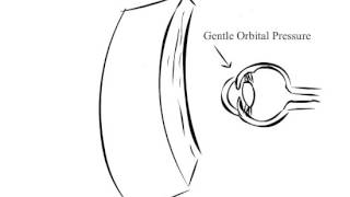 How to Pronounce Striae [upl. by Adham]