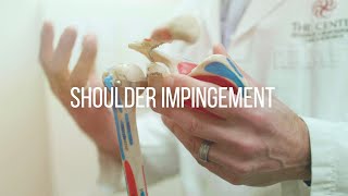 Shoulder Impingement Causes and Treatment [upl. by Essined]