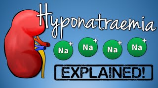 Hyponatremia EXPLAINED with Animation [upl. by Mauer]