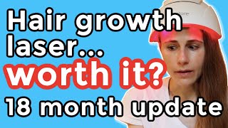 iRestore hair growth laser 18 month update Is it worth it Dr Dray [upl. by Cassaundra]