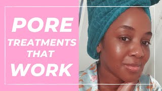 Treatment for Large Pores that WORK Black Skin [upl. by Maisie77]