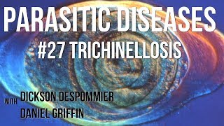 Parasitic Diseases Lectures 27 Trichinellosis [upl. by Derinna]