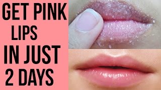 How to get pink lips Lighten dark lips naturally at home Get Rid Of Chapped Lips [upl. by Taite66]