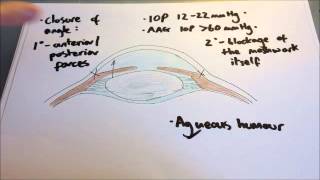 Acute angle closure glaucoma [upl. by Buford]