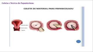 Coloração de Papanicolaou [upl. by Elleivad]