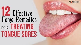 12 Effective Remedies For Treating Tongue Sores  Healthspectra [upl. by Nagorb975]