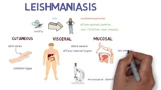 What is Leishmaniasis An introduction and overview [upl. by Strickler235]