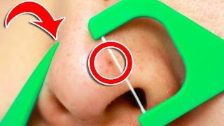 6 Clever Tricks To Unclog Pores INSTANTLY [upl. by Kai707]