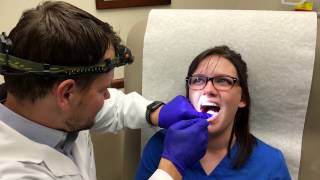 Canker Sore Treatment by Dermatologist Dr David Myers [upl. by Noemi]