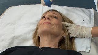 Facial Cupping for Youthful Skin [upl. by Ingold]