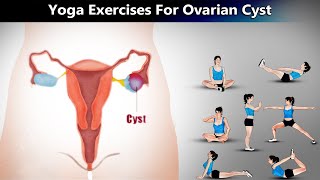 7 Yoga Poses for Ovarian Cyst [upl. by Ronnie202]