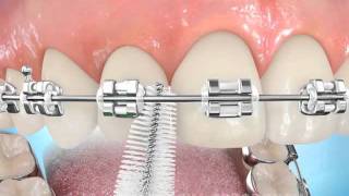 Uso de cepillo interdental [upl. by Odraccir]