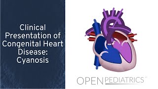 Rheumatic Fever amp Heart Disease  Pathology  Dr Najeeb🫀 [upl. by Lora876]