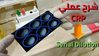 شرح عملي لفحص CRPPractical explanation of CRP examinationserial dilution [upl. by Nalra]