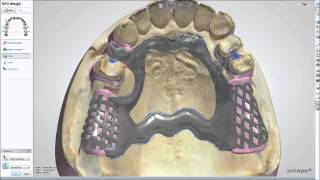 Modellguß im WIELAND 3shape DentalSystem 2013 [upl. by Razaile487]