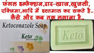 Keto Soap UsesBenefits Side Effects  Ketoconazole 2 ww Soap🔥🔥 [upl. by Yrral370]