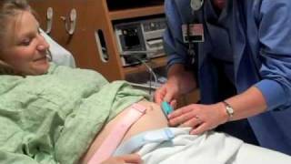 Ultrasounds During Pregnancy [upl. by Ybroc]