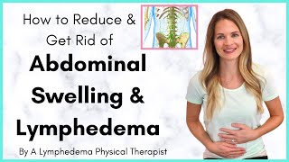 Abdominal Lymphedema and Swelling in the Stomach Treatment  By a Lymphedema Physical Therapist [upl. by Aicat706]