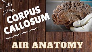 Corpus callosum  Air Anatomy [upl. by Teodorico]