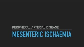 Mesenteric Ischaemia [upl. by Raynata]