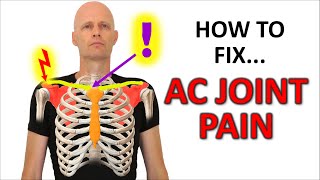 Understanding Sacroiliac Joint Pain [upl. by Lokim682]