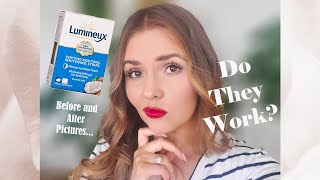 Lumineux Whitening Strips  Honest Review [upl. by Chavaree]