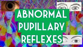 Abnormal pupillary reflexes [upl. by Mahsih]