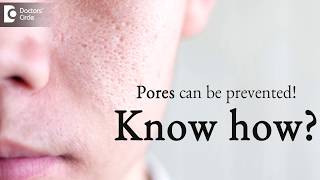 How to prevent pores on face  DrKC Nischal  Doctors Circle [upl. by Rochelle]