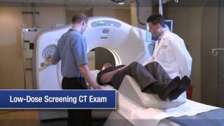 Low Dose CT Lung Screening [upl. by Katzen]