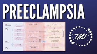 Preeclampsia Explicada Claramente [upl. by Liahcim716]