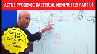 Acute Pyogenic Bacterial Meningitis Part 1 🩺 [upl. by Gurtner382]