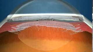 How Fluid Circulates in the Eye [upl. by Kciv]