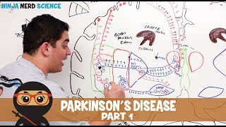 Parkinsons Disease  Clinical Presentation  Part 1 [upl. by Pepin]