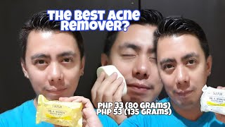 DR WONG SULFUR SOAP FOR ACNE SCABICIDE PEDICULICIDE  REAL TALK REVIEW amp DEMONSTRATION [upl. by Shannon]