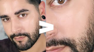 How I Shrunk My Pores  Smaller tighter Clearer Pores ✖ James Welsh [upl. by Draned]