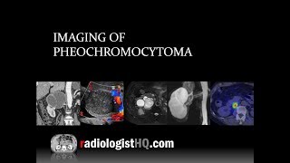 Addisons Disease  Overview clinical features pathophysiology investigations treatment [upl. by Mcdermott]